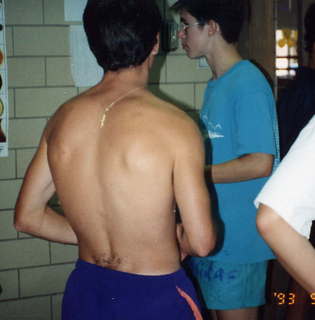 335 1i1. CHS XC 1993, Mike Gross (from behind) and Dave Caron