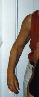 629 2s1. arm