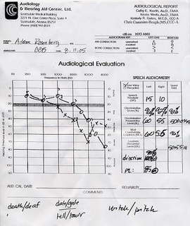 audiology hearing test chart