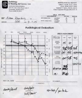 audiology hearing test chart