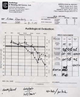 audiology hearing test chart