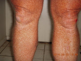 my scraped up knee