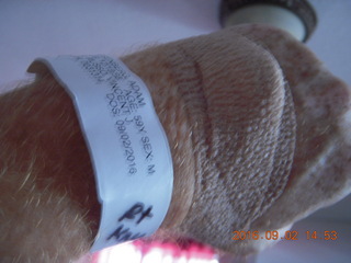 after knee operation