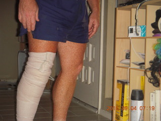 after knee operation