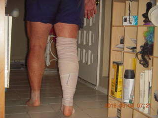 after knee operation