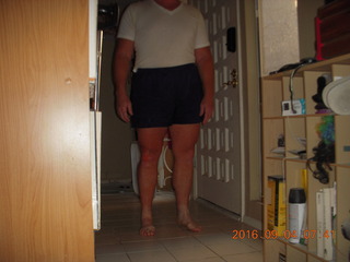 two days after my knee surgery