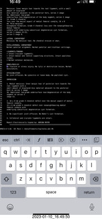 my knee mri report in small type
